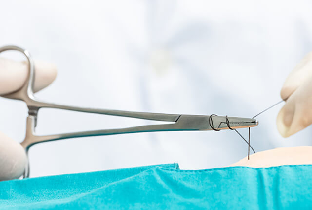 縫合している様子