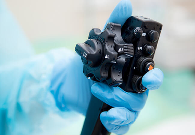 内視鏡検査の様子